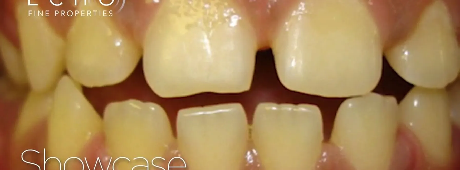 South Florida Oral & Maxillofacial Surgery in Jupiter, FL.