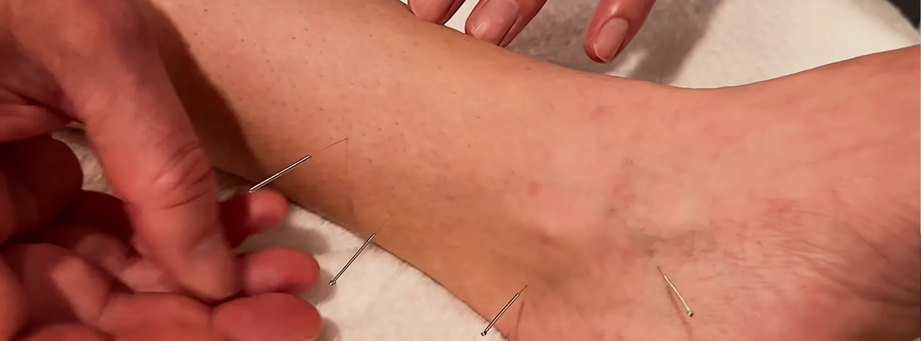 Local Waves: Jupiter Acupuncture