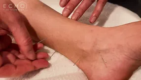 Local Waves: Jupiter Acupuncture